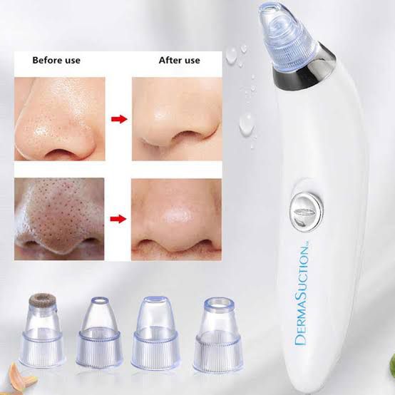 Derma Suction Blackhead Removal Machine 4-in-1 – Pore Cleaner & Skin Rejuvenation Tool