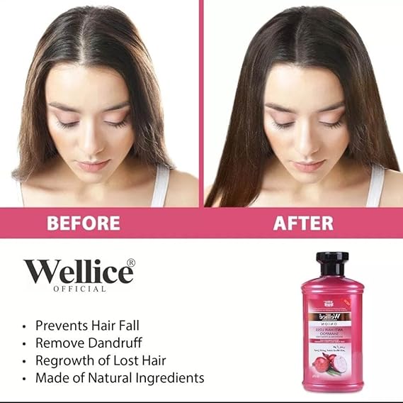 Wellice Onion Anti Hair Loss Hair Oil