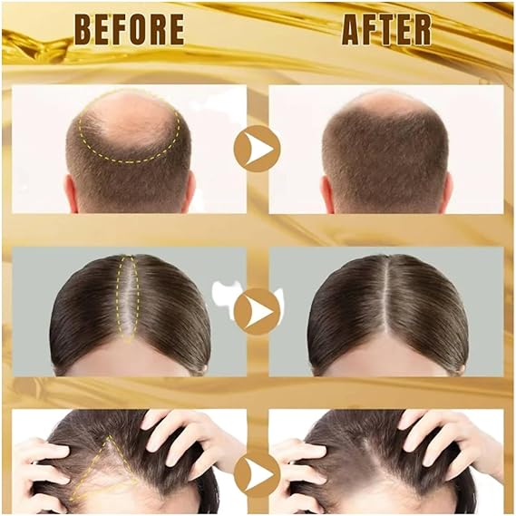 Wellice Onion Anti Hair Loss Hair Oil